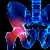 股関節痛を改善させる2つのポイント